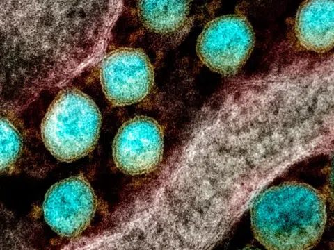 Phát hiện siêu kháng thể chống được 23 biến chủng nCoV